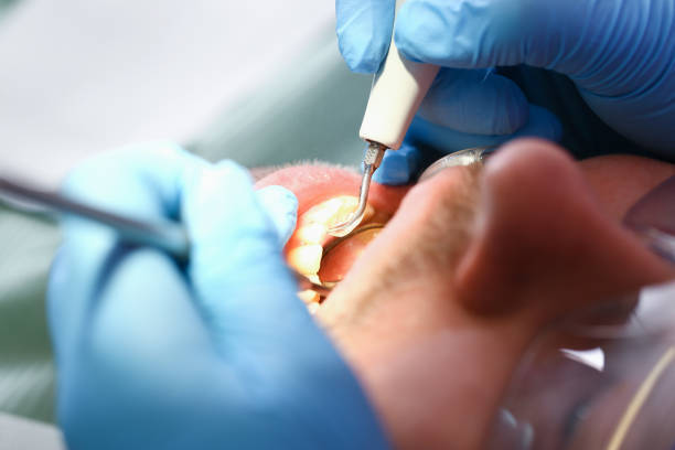 Best Walk-In Emergency Dentist in Denton, TX