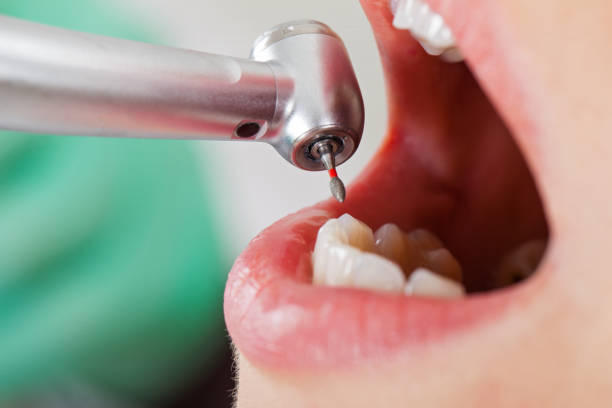 Best Pediatric Emergency Dentist in Denton, TX